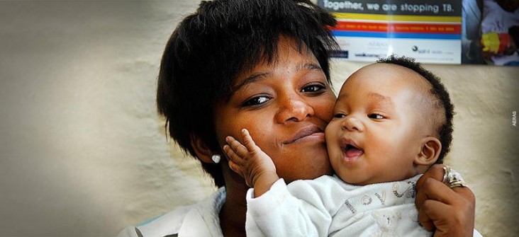 A young woman infected with TB. 