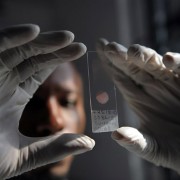 A laboratory technician prepares a sample for genotyping at the government-run Ifakara Health Institute in Bagamoyo, Tanzania, w